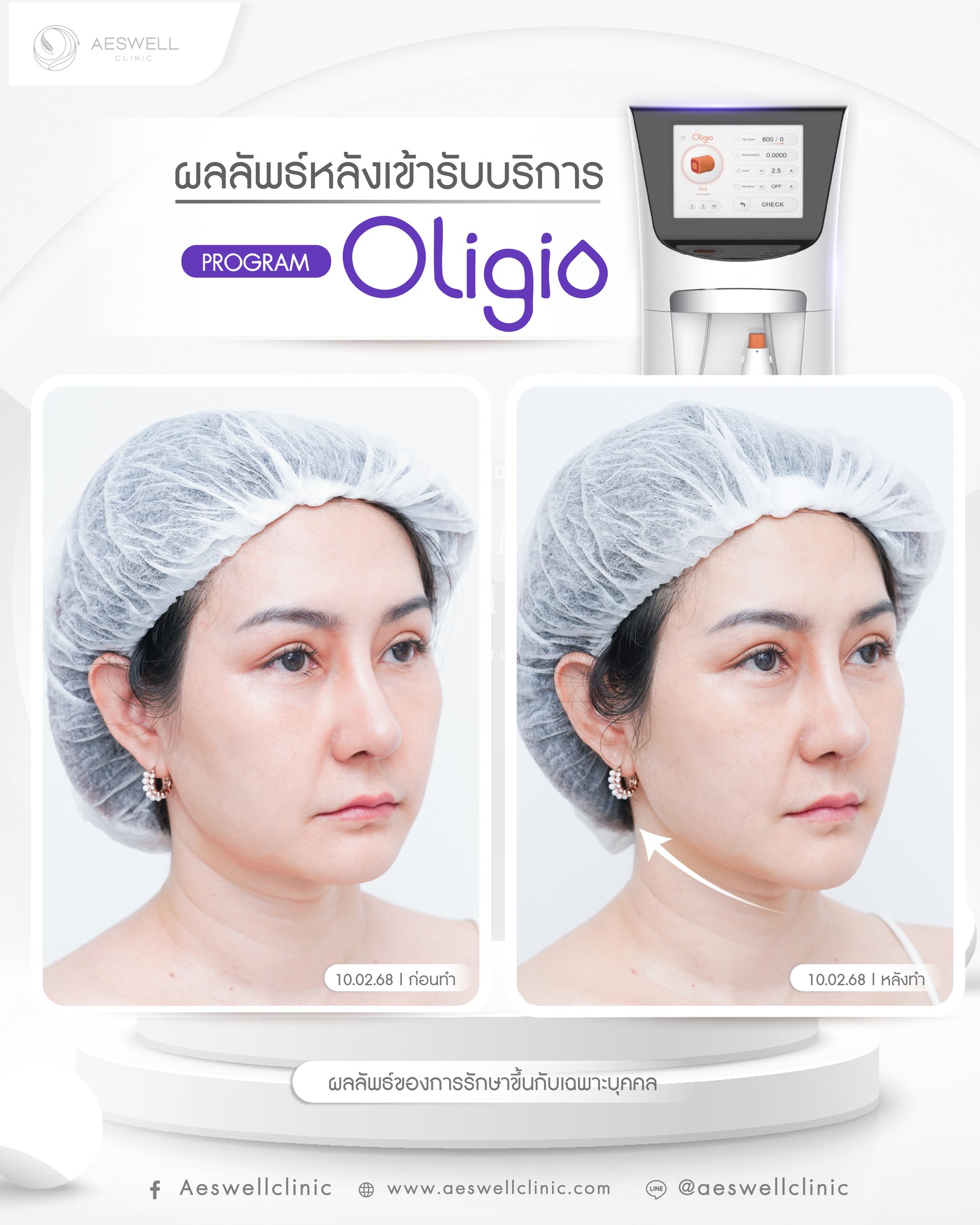 รีวิวจากผู้ใช้บริการจริง