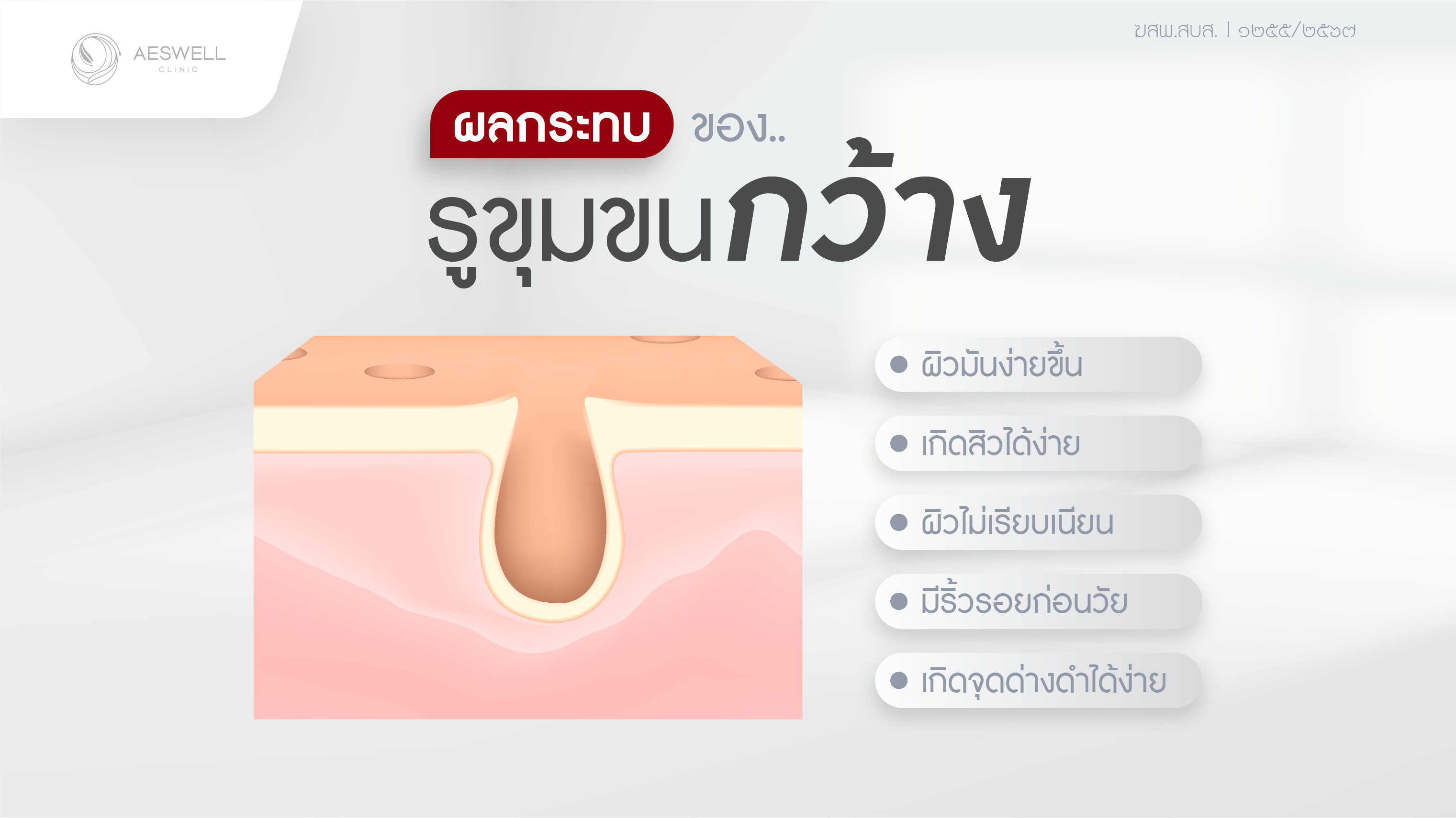 ผลกระทบของรูขุมขนกว้างมีอะไรบ้าง