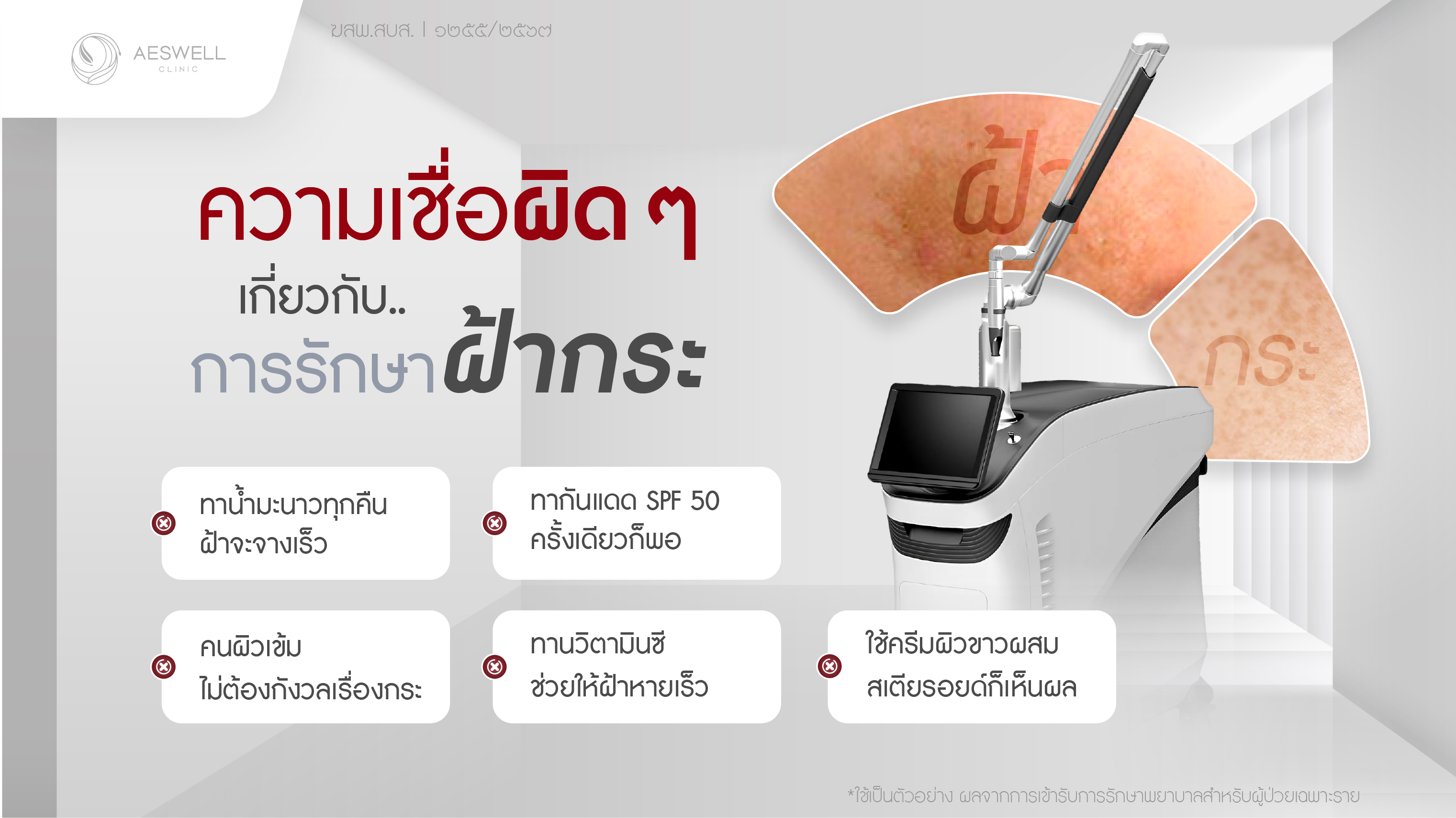 ความเชื่อผิด ๆ เกี่ยวกับการรักษาฝ้ากระ