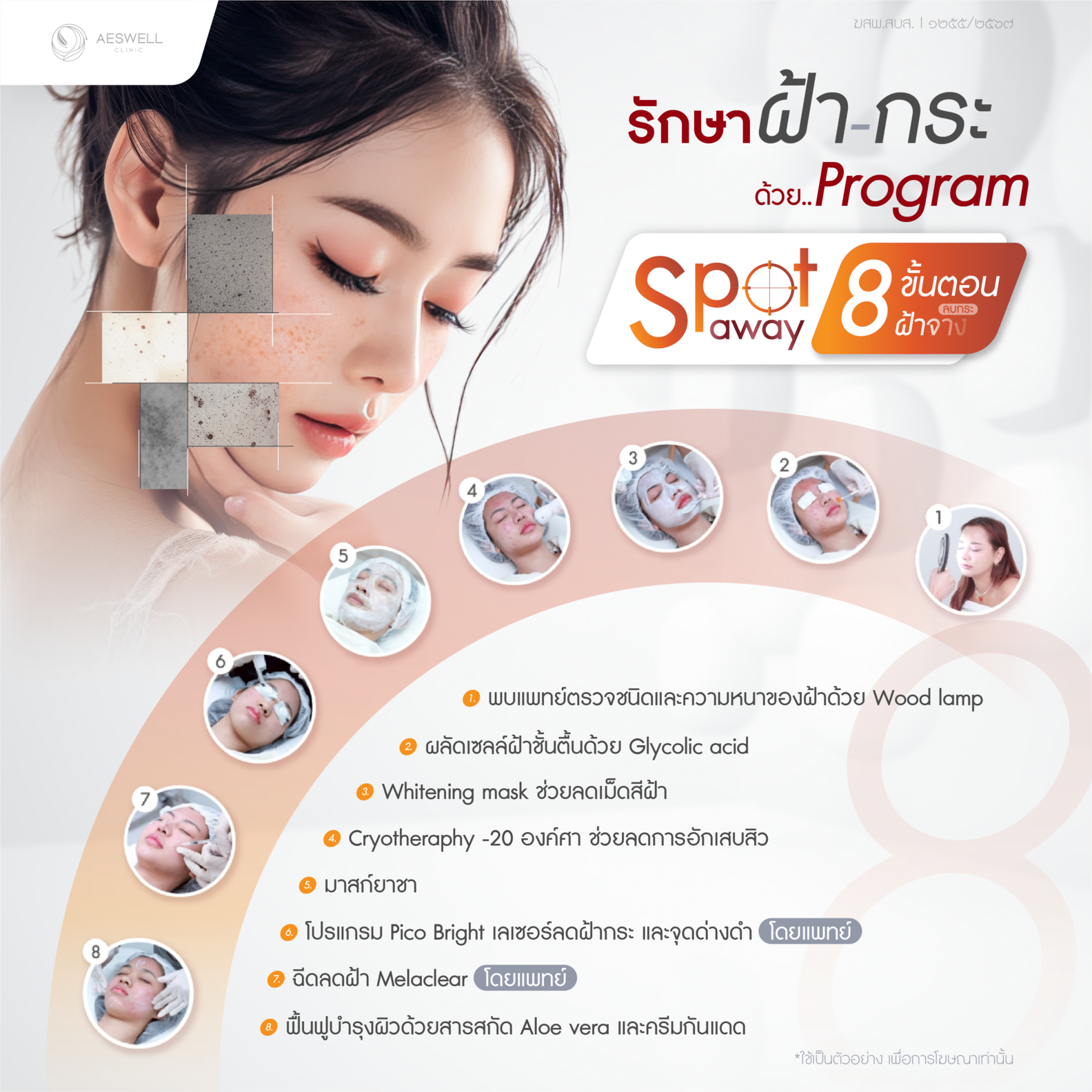 รักษาฝ้ากระด้วยโปรแกรม Spot Away 8 ขั้นตอน รักษาฝ้ากระด้วยโปรแกรม Spot Away 8 ขั้นตอน