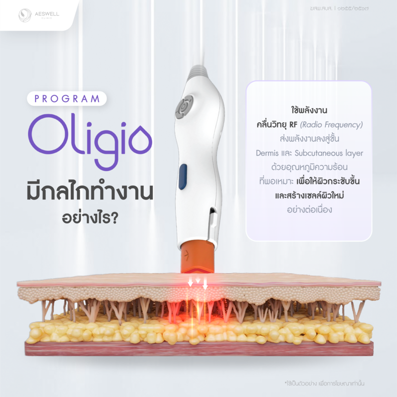 โปรแกรม Oligio มีกลไกทำงานอย่างไร โปรแกรม Oligio มีกลไกทำงานอย่างไร