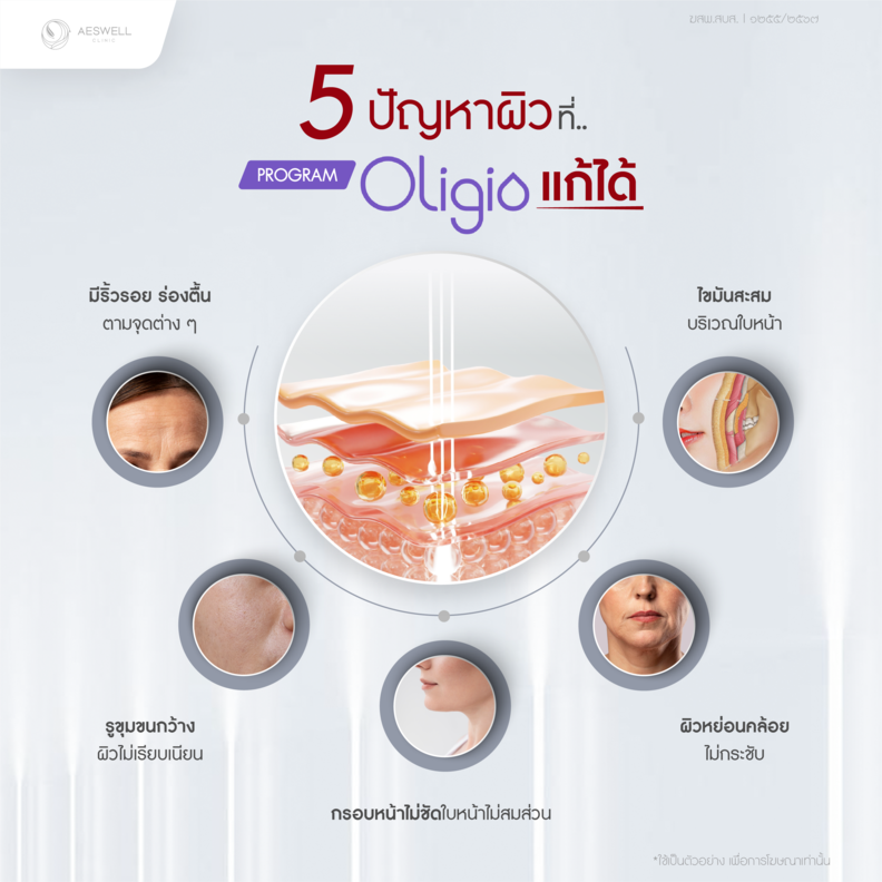 5 ปัญหาผิวที่โปรแกรม Oligio แก้ได้ 5 ปัญหาผิวที่โปรแกรม Oligio แก้ได้