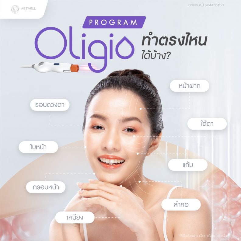 โปรแกรม Oligio ทำตรงไหนได้บ้าง โปรแกรม Oligio ทำตรงไหนได้บ้าง