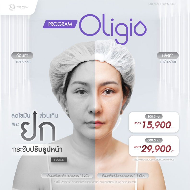 โปรแกรม Oligio ลดริ้วรอย ราคากี่บาท โปรแกรม Oligio ลดริ้วรอย ราคากี่บาท