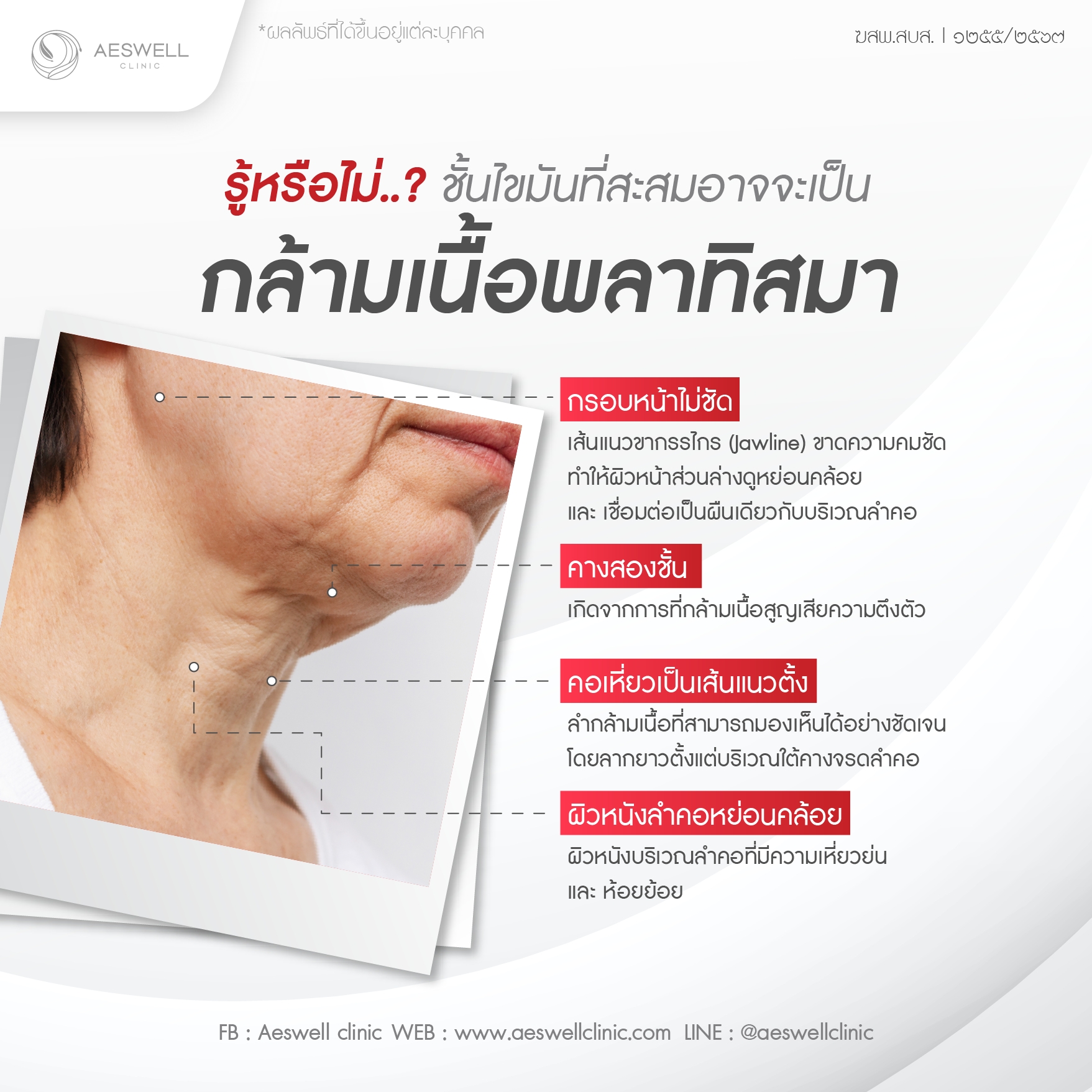 เหนียงคืออะไร? เข้าใจโครงสร้างลึกก่อนเริ่มลดเหนียง