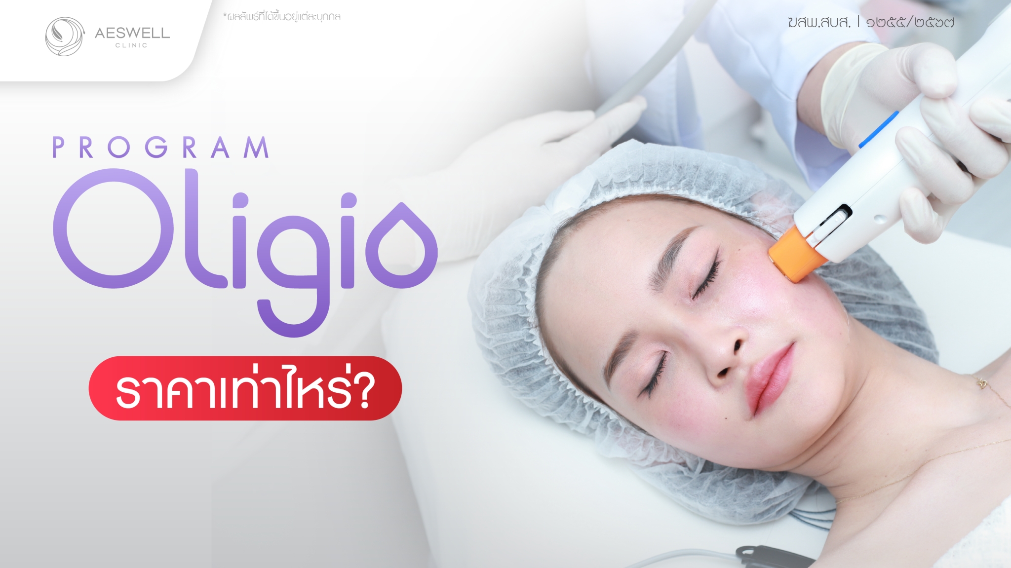 โปรแกรม Oligio ราคาเท่าไหร่