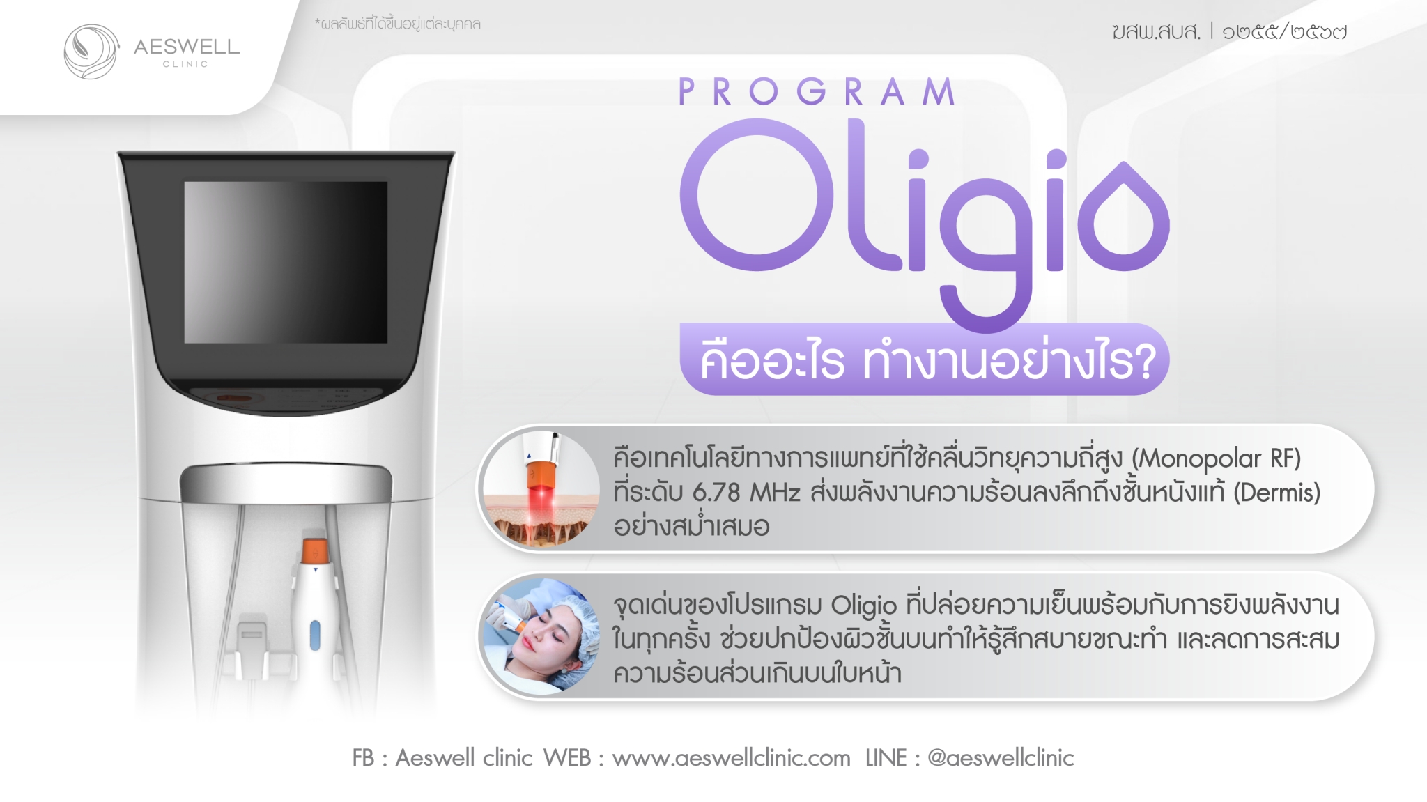 โปรแกรม Oligio คืออะไร ทำงานอย่างไร?