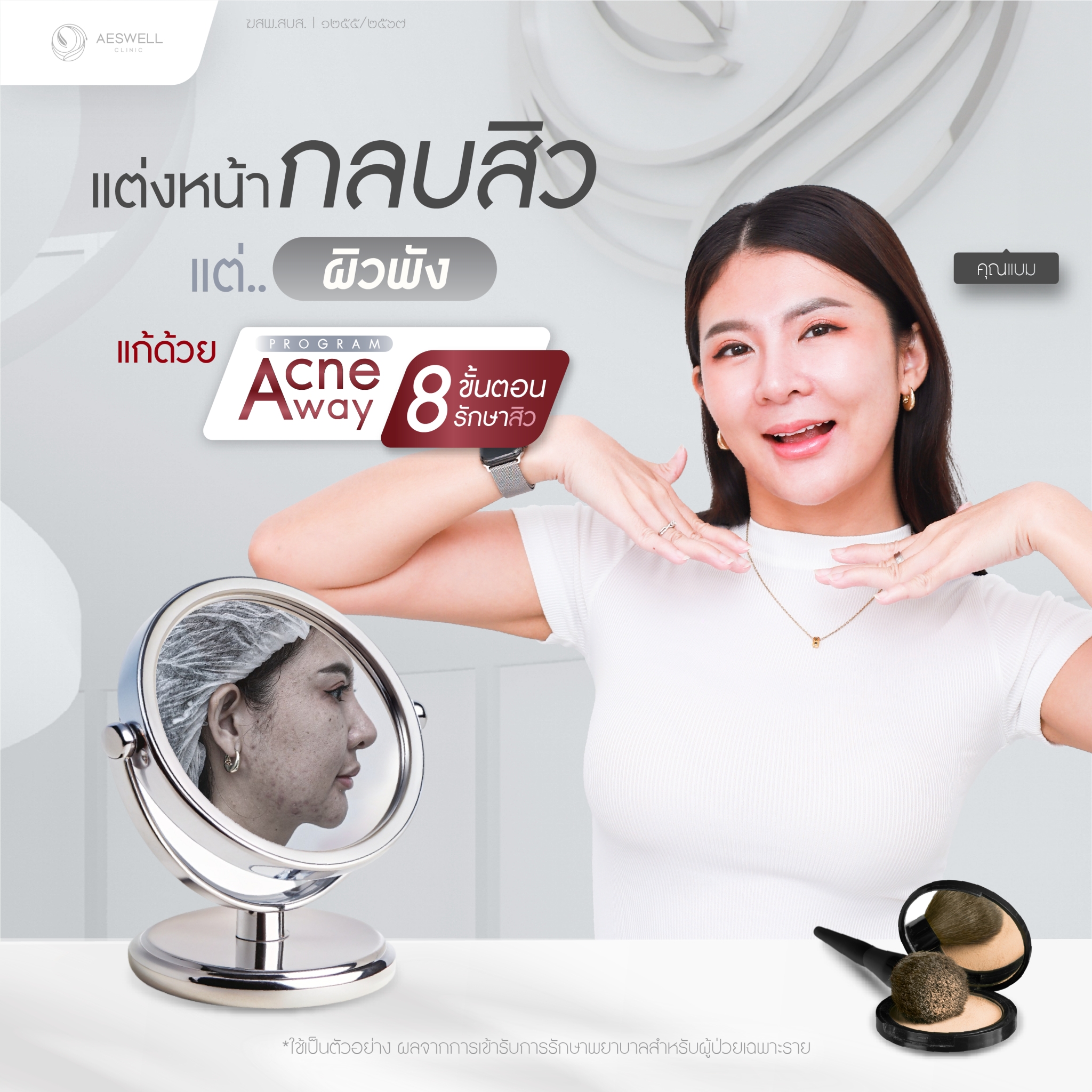 รีวิวโปรแกรม Acne Away