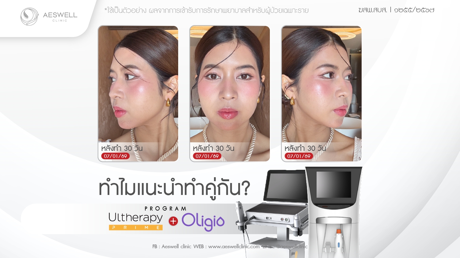 ทำไมแนะนำ โปรแกรม Ulthera Prime + โปรแกรม Oligio คู่กัน?