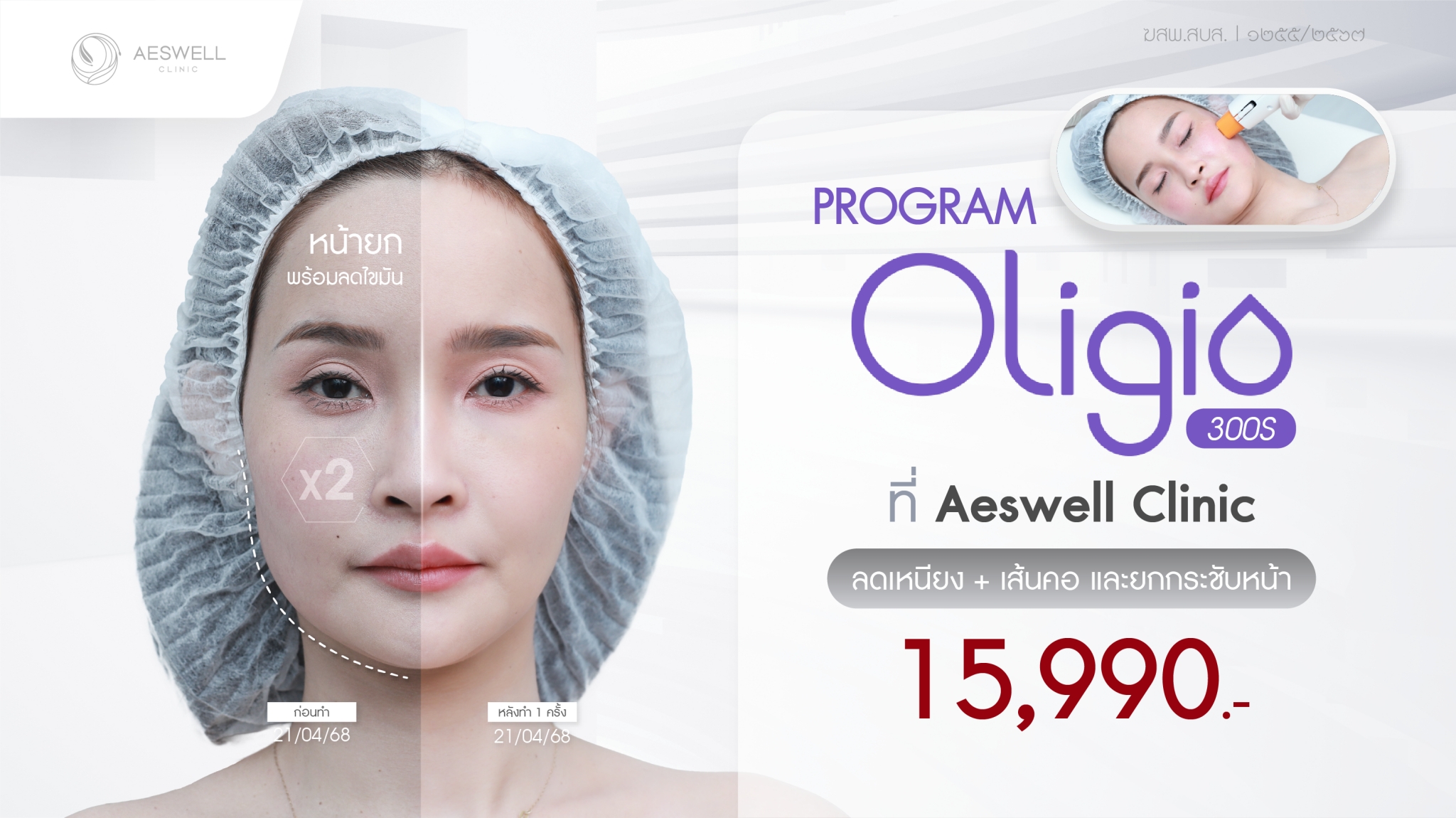 ราคาโปรแกรม Oligio ที่ Aeswell Clinic