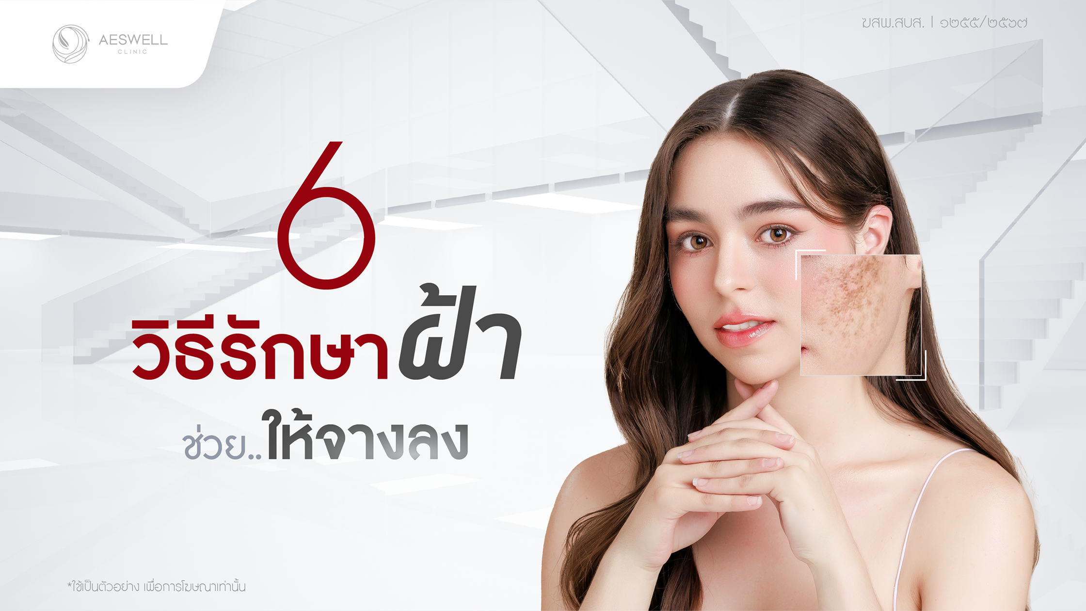 วิธีรักษาฝ้า