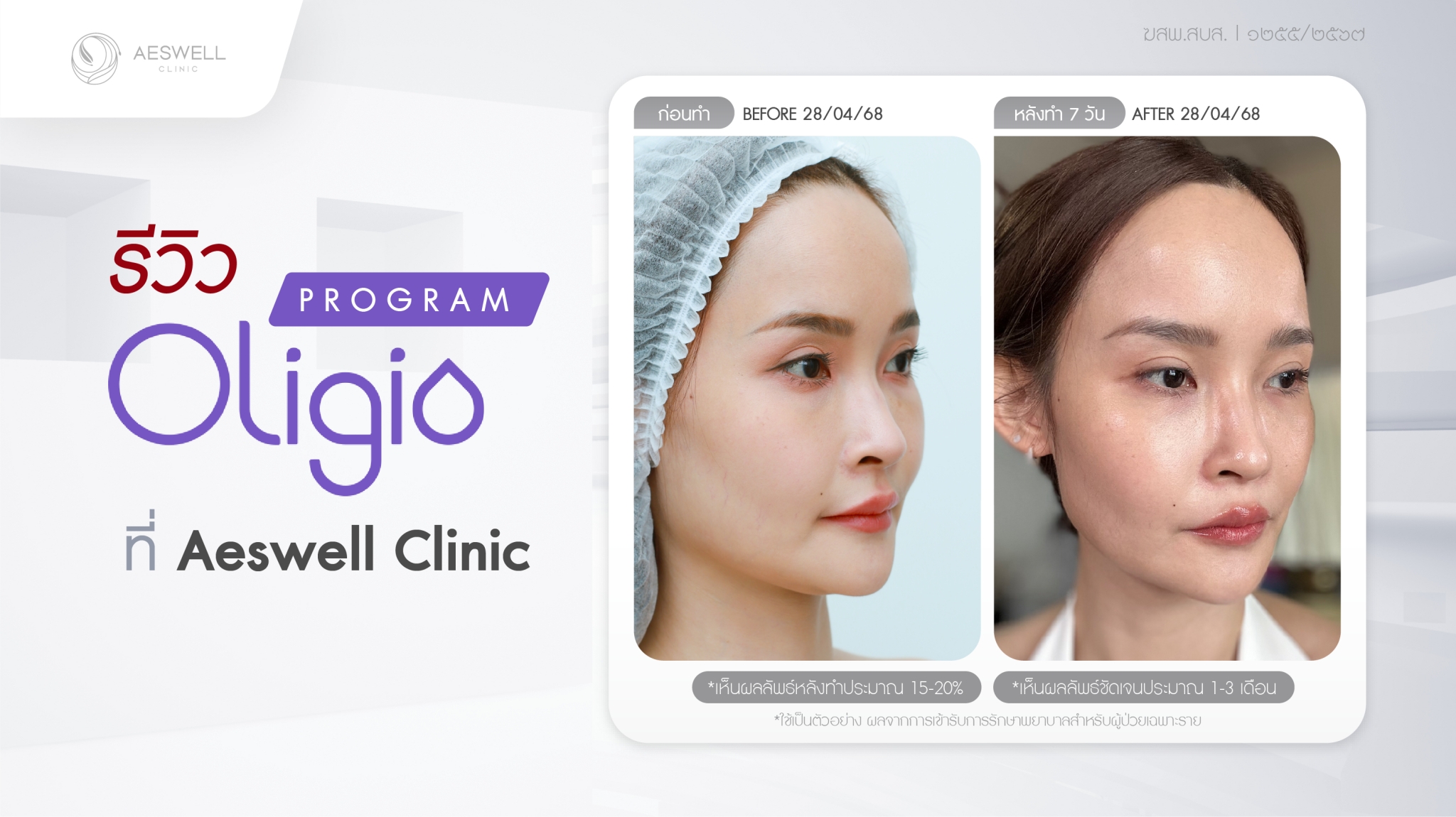 รีวิว โปรแกรม Oligio