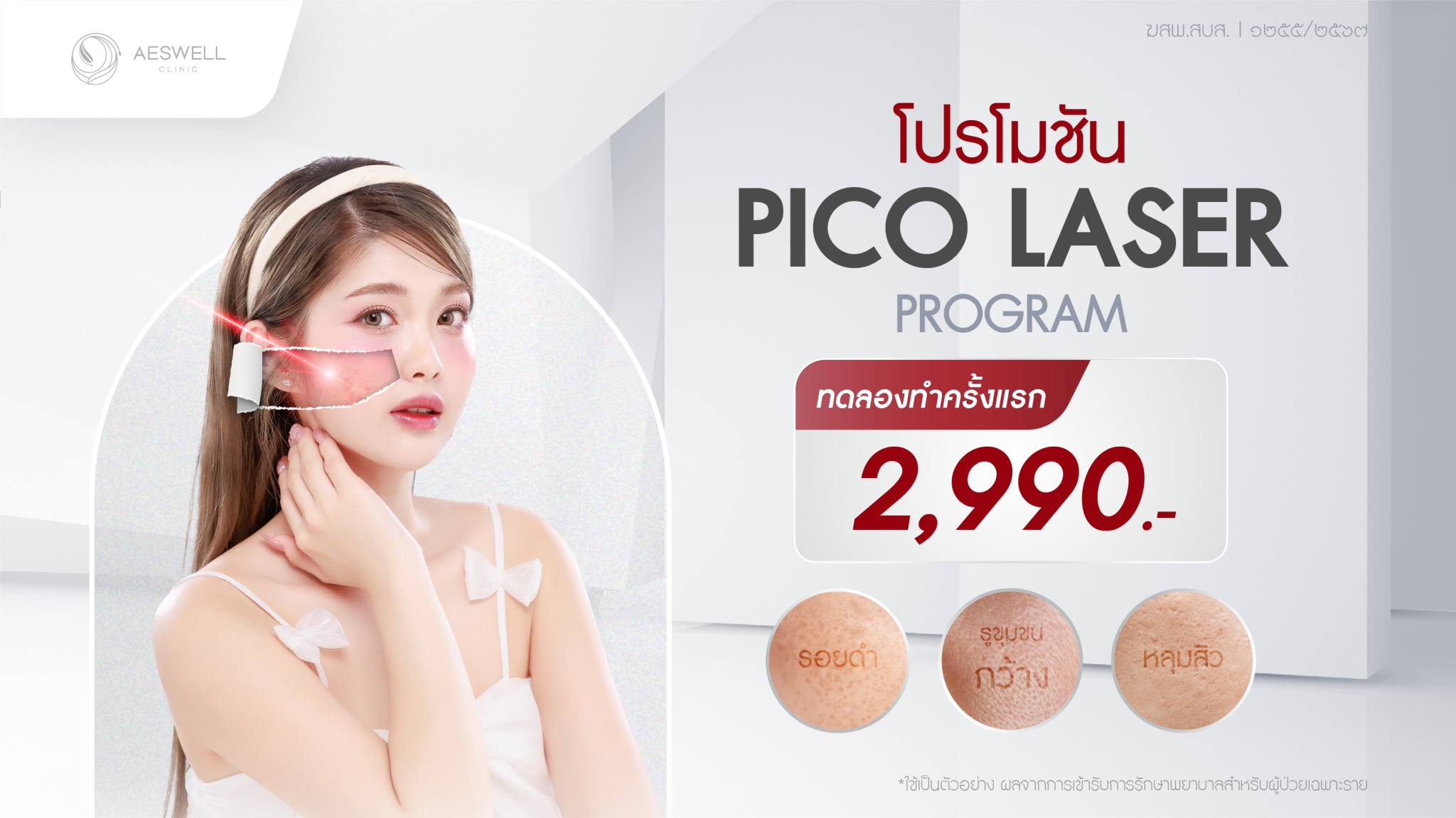 โปรโมชัน pico laser