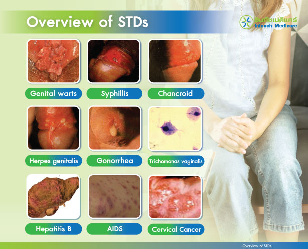 Overview of STDs Overview of STDs