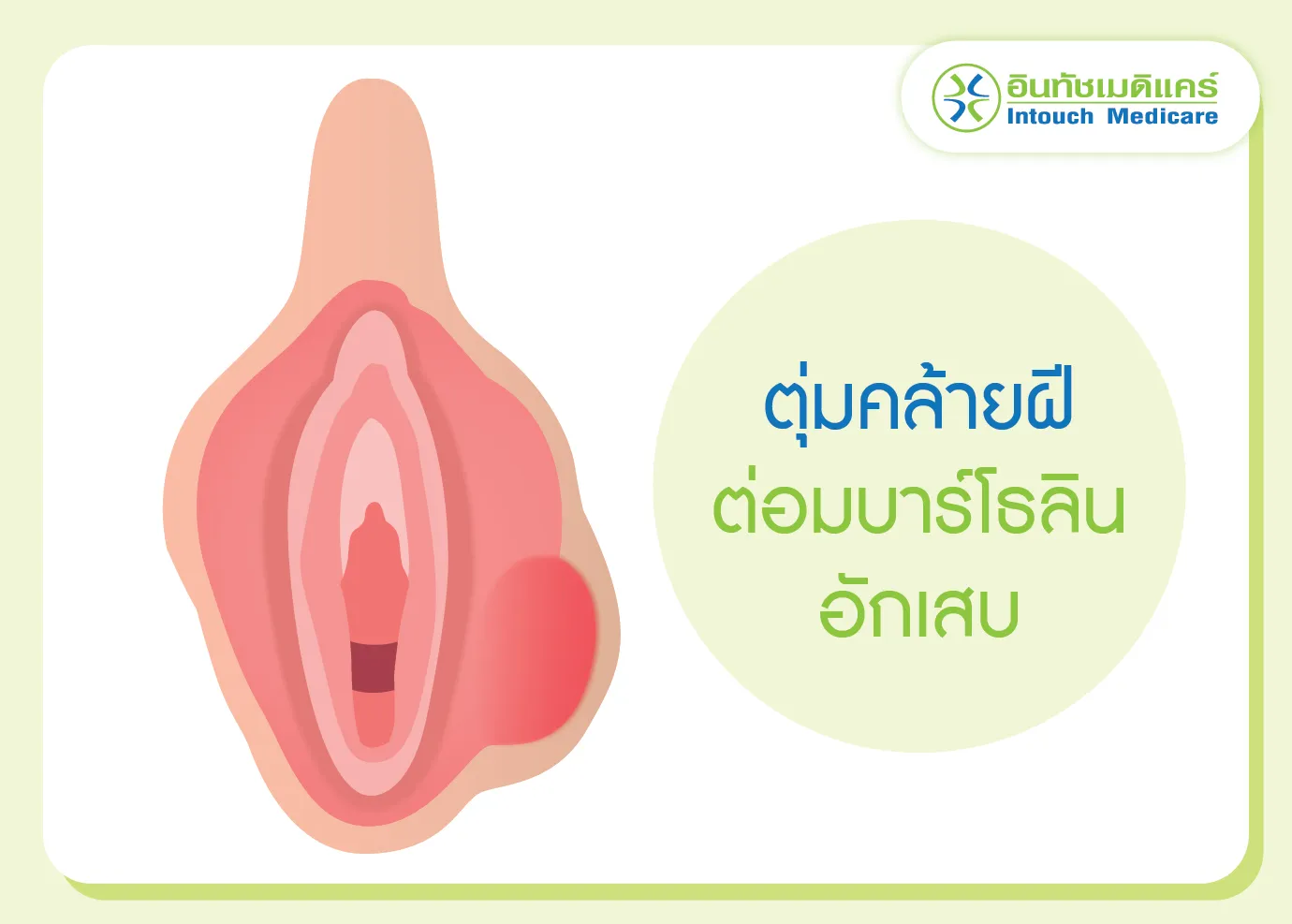 ต่อมบาร์โธลินอักเสบ มีลักษณะเป็นตุ่มคล้ายฝี