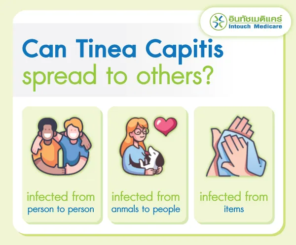 Can Tinea Capitis spread to others?