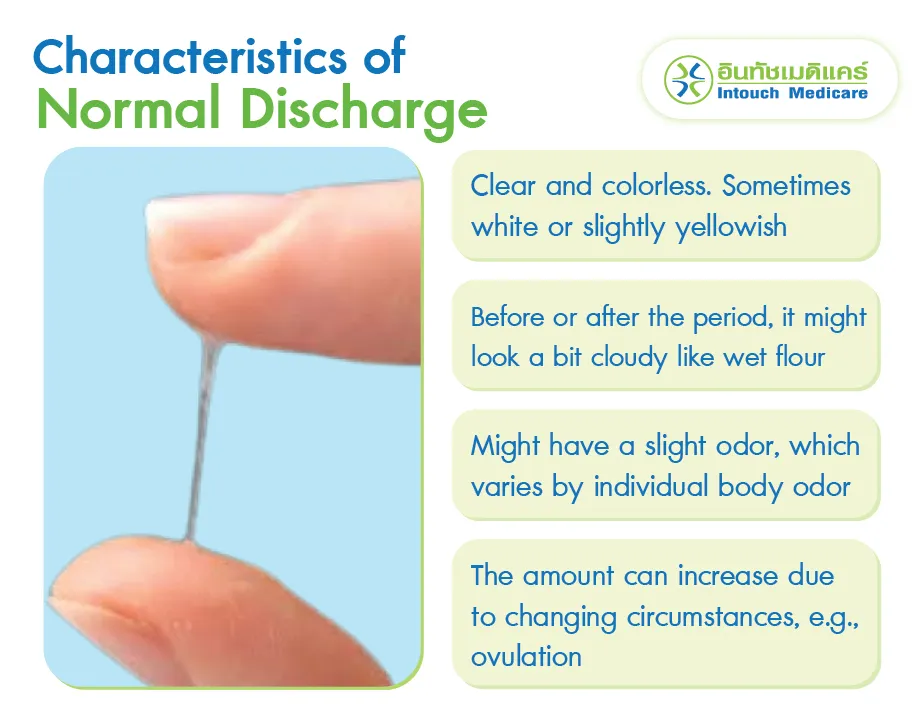 Characteristics of Normal Discharge