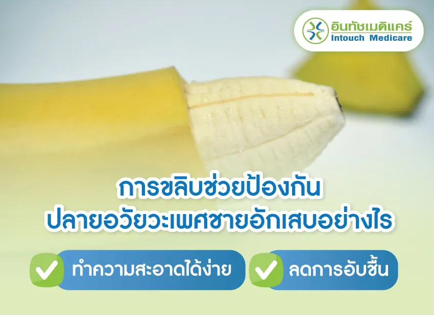 การขลิบช่วยป้องกันปลายอวัยวะเพศอักเสบ การขลิบช่วยป้องกันปลายอวัยวะเพศอักเสบ