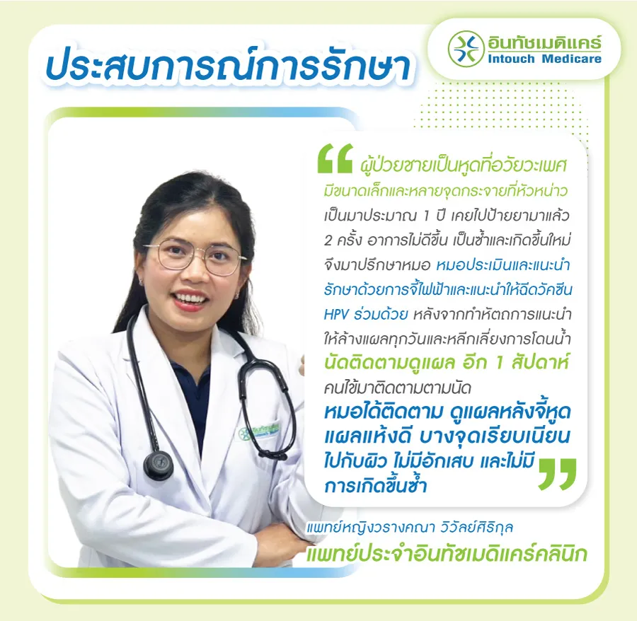 ประสบการณ์รักษาของแพทย์จี้หูด ประสบการณ์รักษาของแพทย์จี้หูด