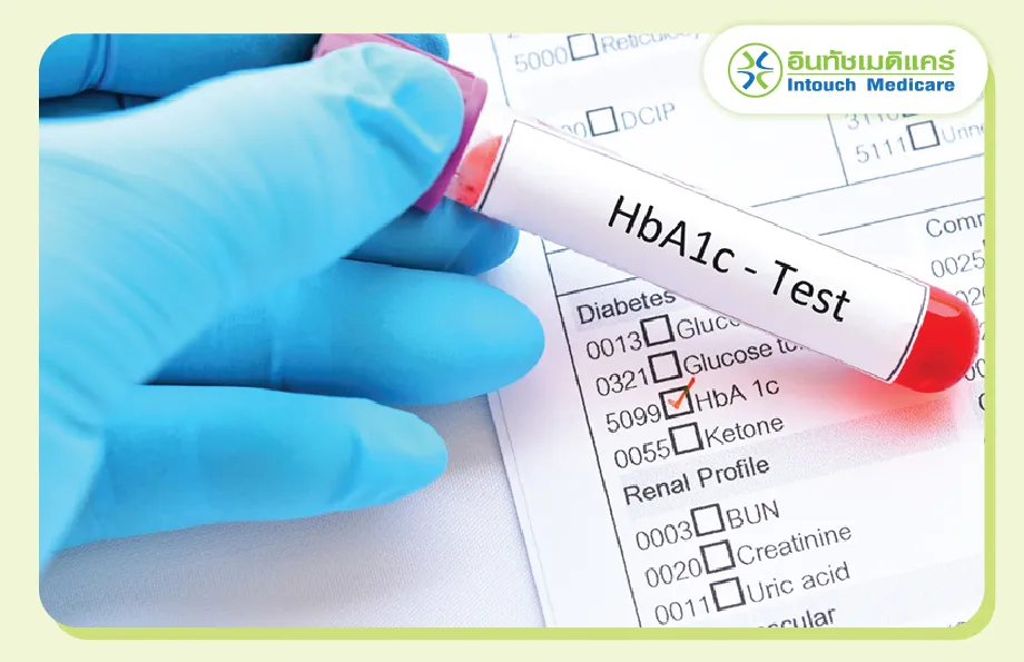 การตรวจระดับน้ำตาลสะสม (HbA1C)