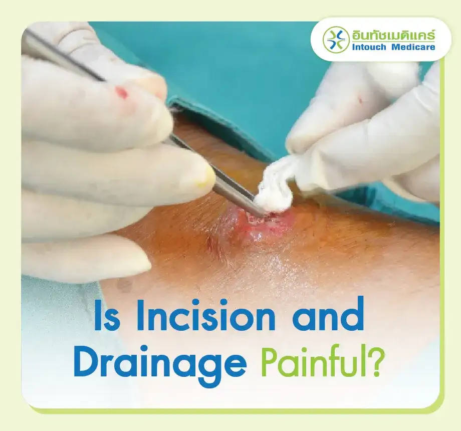 Is Incision and Drainage Painful?