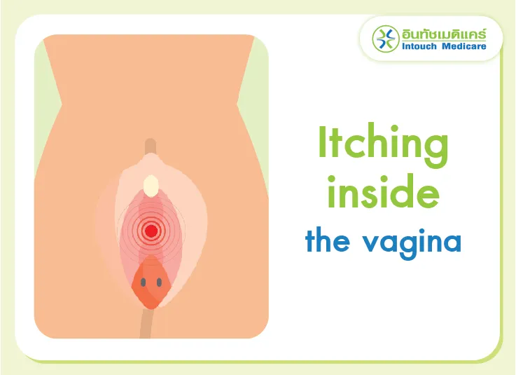 Itching inside the vagina Itching inside the vagina