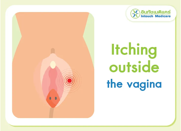 Itching outside the vagina Itching outside the vagina