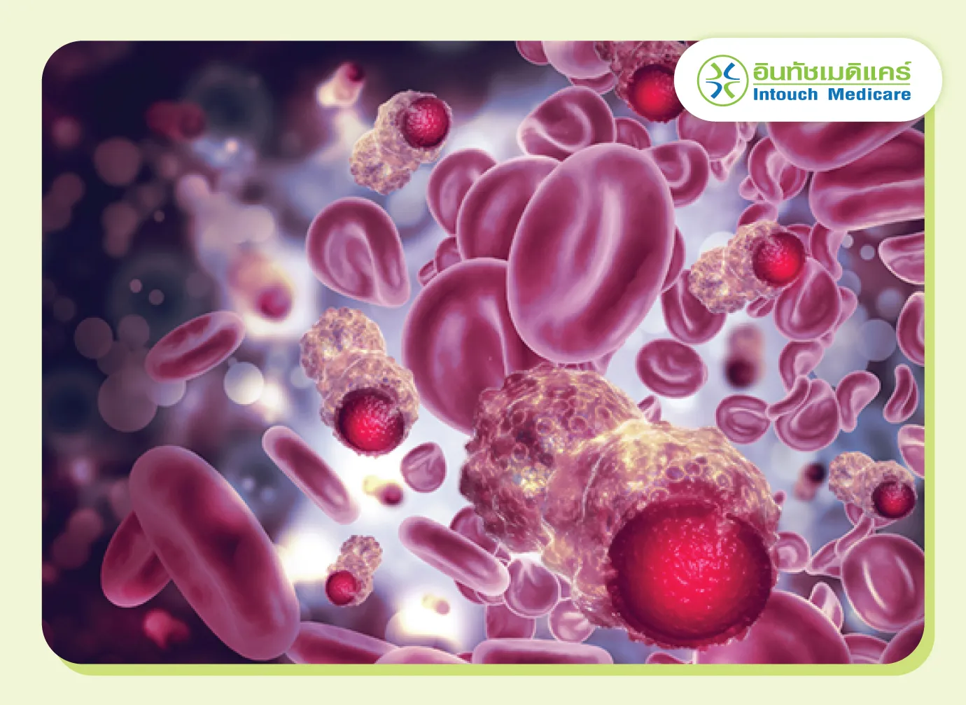 เม็ดเลือดแดงที่ต่ำกับมะเร็งเม็ดเลือด เม็ดเลือดแดงที่ต่ำกับมะเร็งเม็ดเลือด
