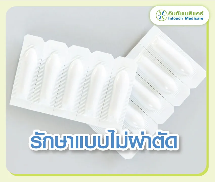 รักษาแบบไม่ผ่าตัด รักษาแบบไม่ผ่าตัด