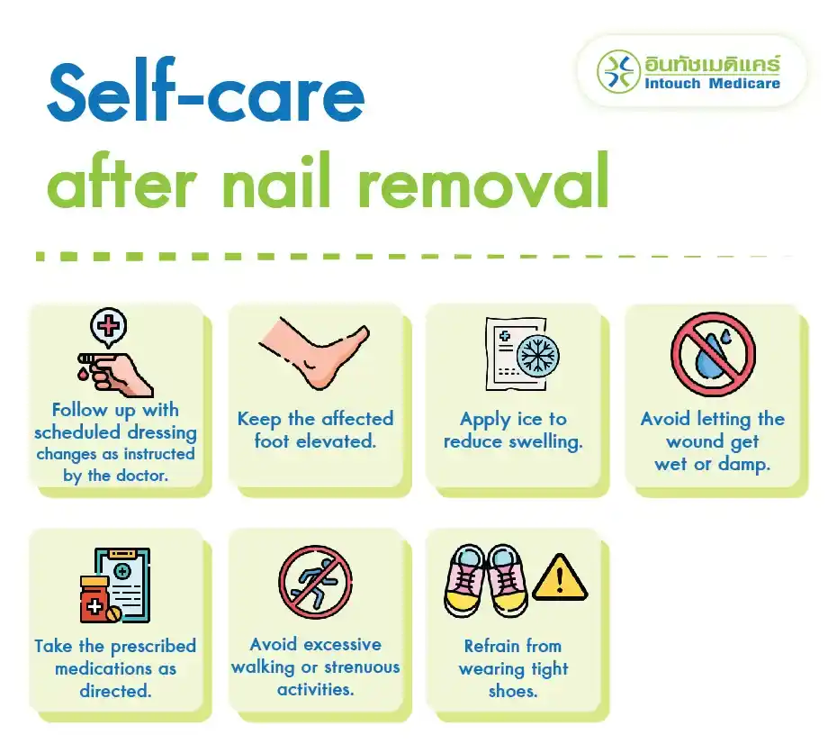 Self-care after nail removal.