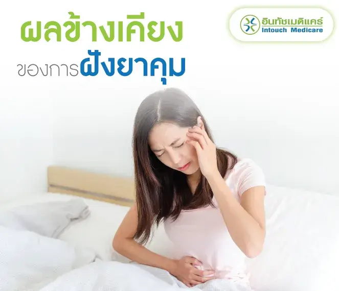 ผลข้างเคียงของการฝังยาคุมกำเนิด ผลข้างเคียงของการฝังยาคุมกำเนิด