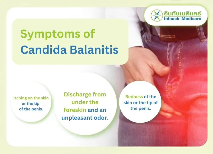 Symptoms of Candida Balanitis