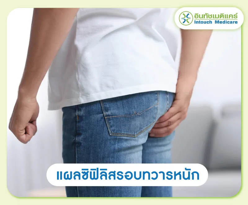 แผลซิฟิลิสรอบทวารหนัก แผลซิฟิลิสรอบทวารหนัก
