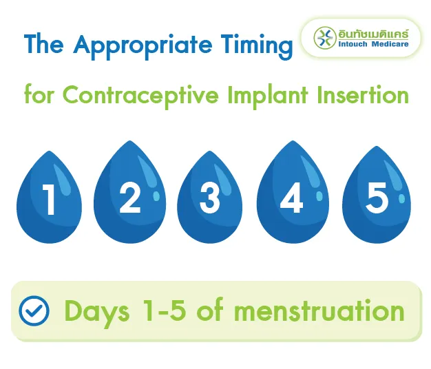 The Appropriate Timing for Contraceptive Implant Insertion