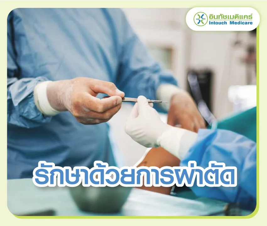 รักษาด้วยการผ่าตัด รักษาด้วยการผ่าตัด