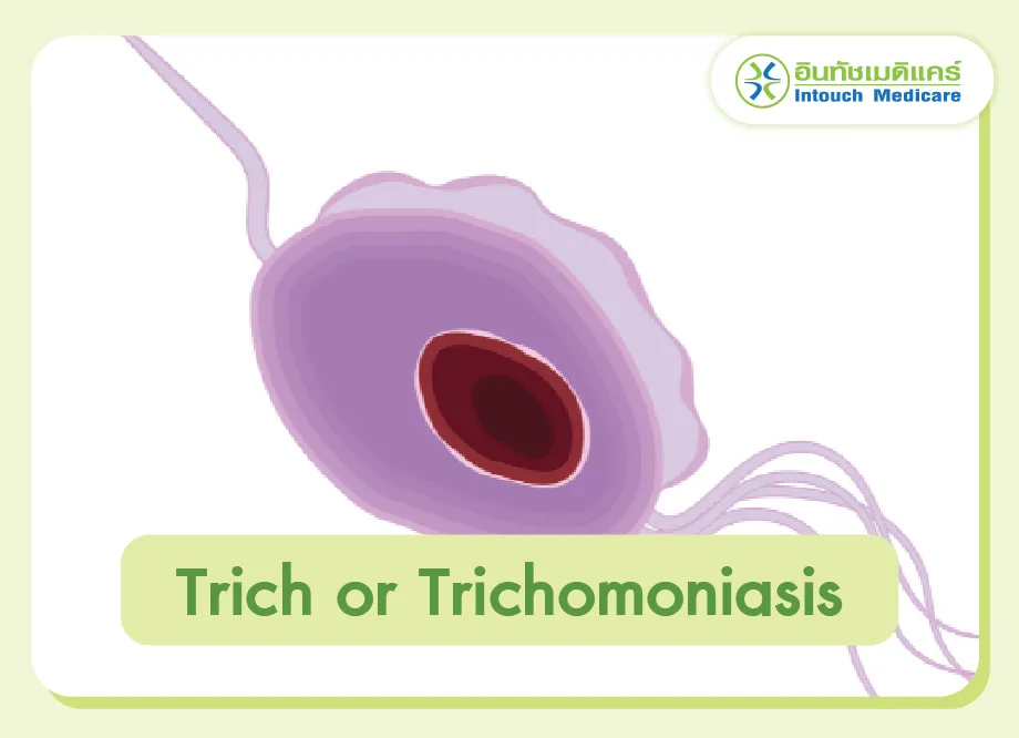 Trich or Trichomoniasis