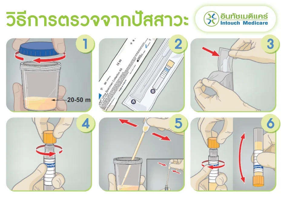 วิธีการตรวจจากปัสสาวะ วิธีการตรวจจากปัสสาวะ
