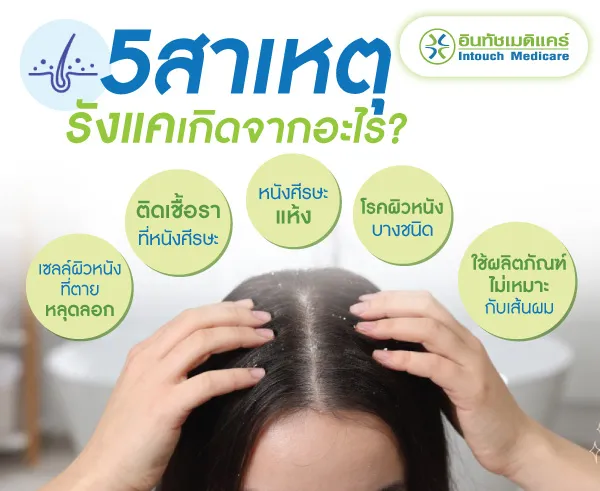 รังแค เกิดจาก อะไร รังแค เกิดจาก อะไร