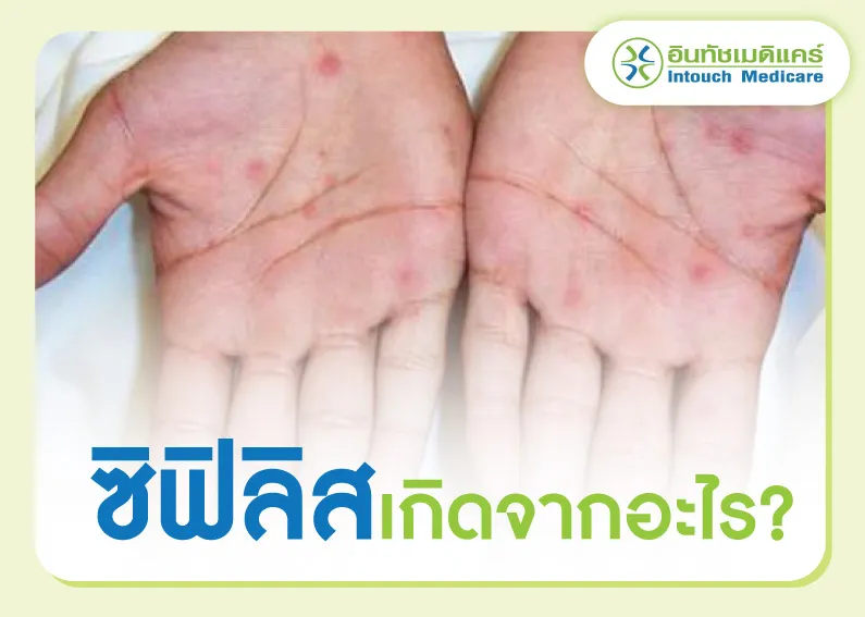 โรคซิฟิลิสเกิดจากอะไร โรคซิฟิลิสเกิดจากอะไร