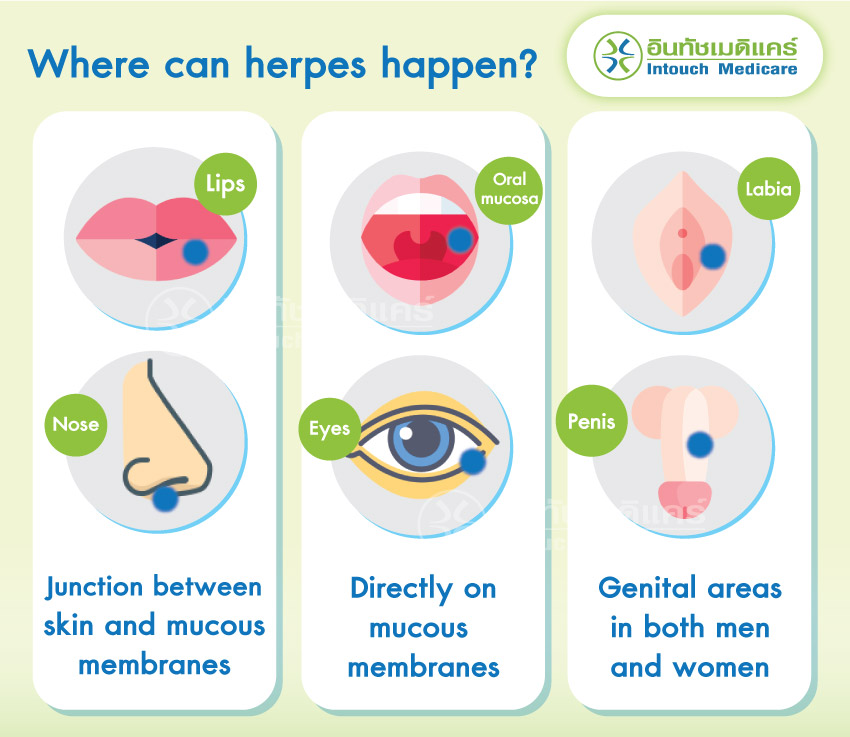 Where can herpes happen?