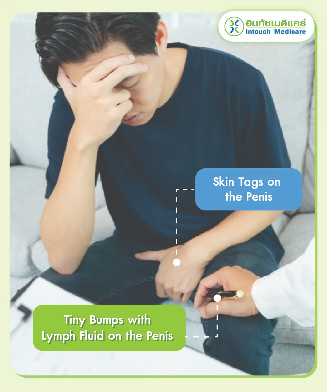 Skin Tags on  the Penis Skin Tags on  the Penis