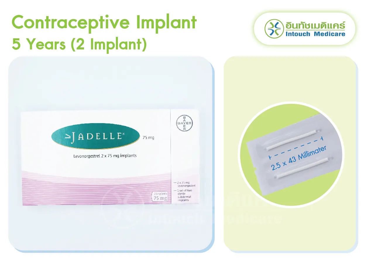 Contraceptive implant 5 years Jadelle brand