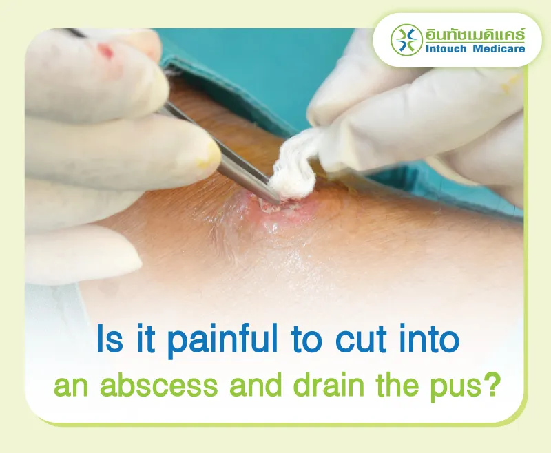 Is it painful to cut into an abscess and drain the pus?
