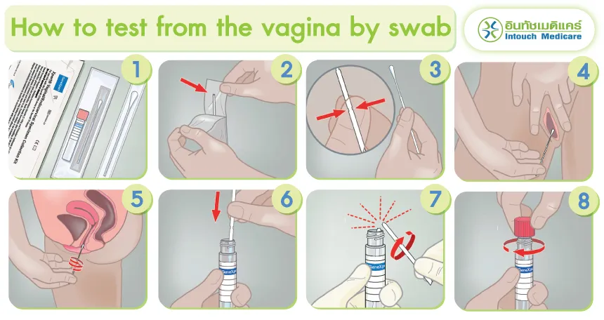 How to test from the vagina by swab How to test from the vagina by swab