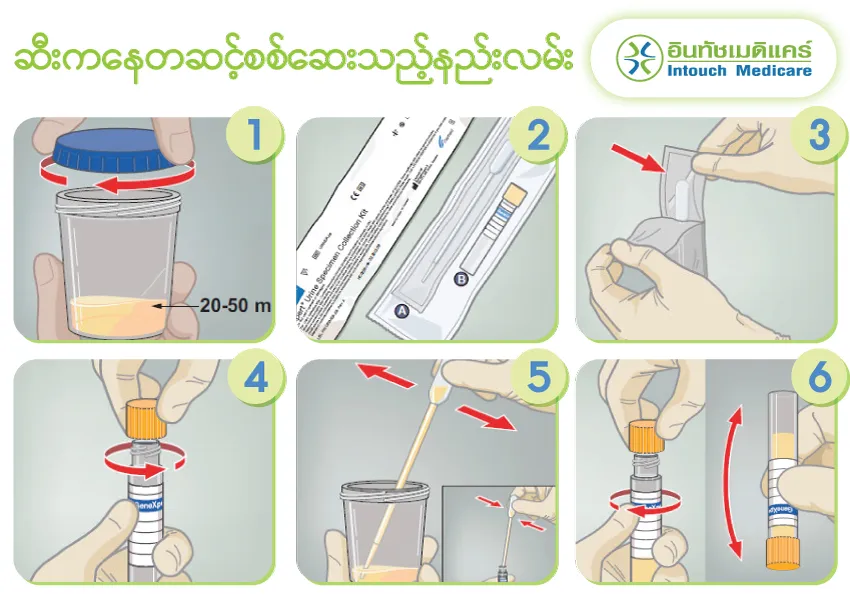 ဆီးကနေတဆင့်စစ်ဆေးသည့်နည်းလမ်း ဆီးကနေတဆင့်စစ်ဆေးသည့်နည်းလမ်း