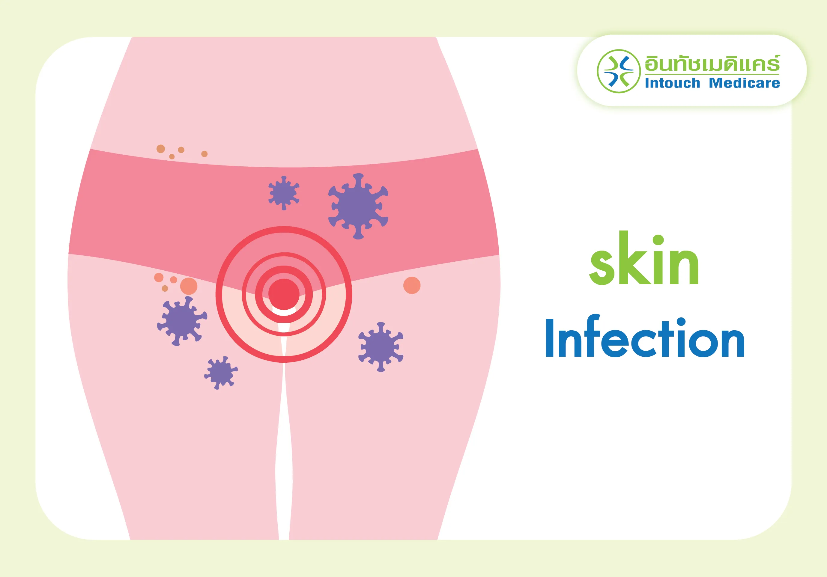 skin_infection skin_infection