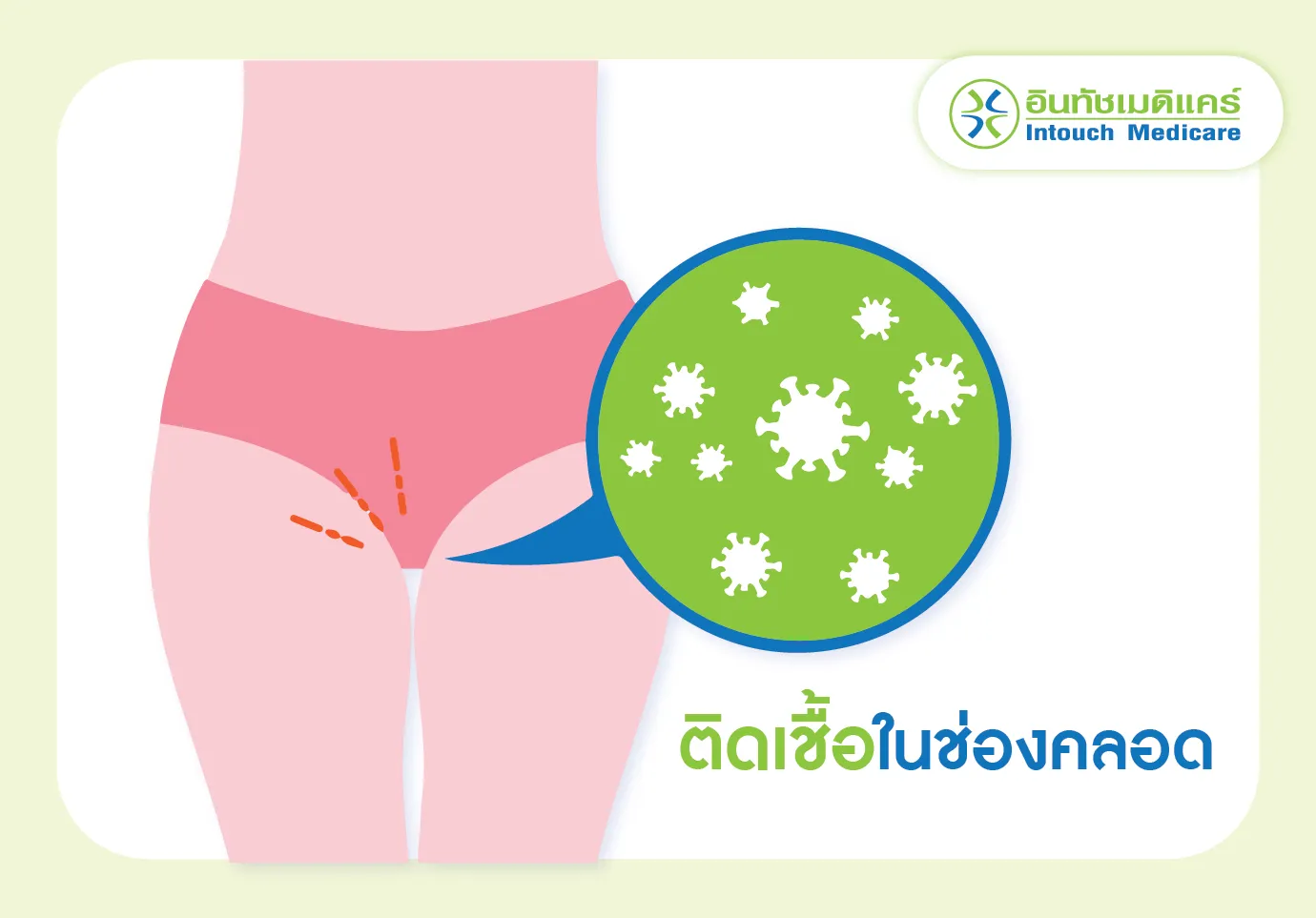 ติดเชื้อในช่องคลอด จากการใส่กางเกงในซ้ำ ติดเชื้อในช่องคลอด จากการใส่กางเกงในซ้ำ