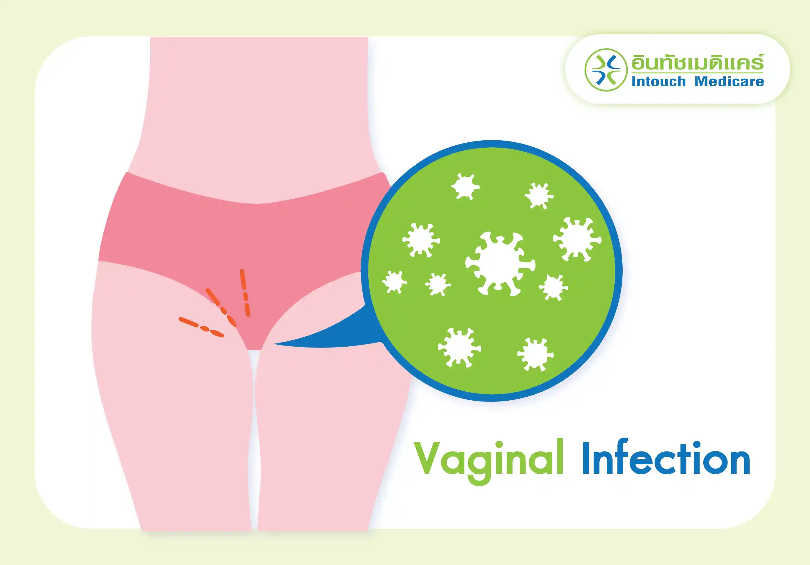 vaginal_infection