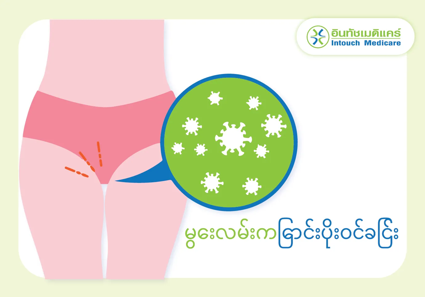 vaginal_infection vaginal_infection