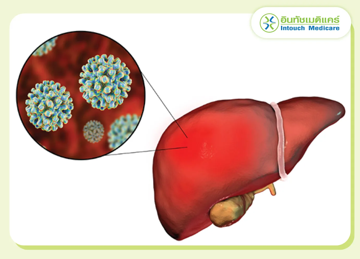 What is Hepatitis B?